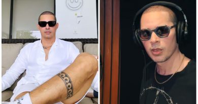 leoni torres trasplante cabello