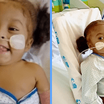 Se recupera Amanda, la niña cubana que recibió un trasplante de hígado